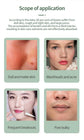 Espátula facial vibratoria para limpieza de poros