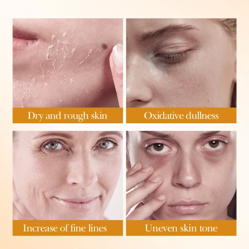 Set de Skincare de Arroz BIOAQUA 5 Piezas – Aclarante, Hidratante y Nutritivo