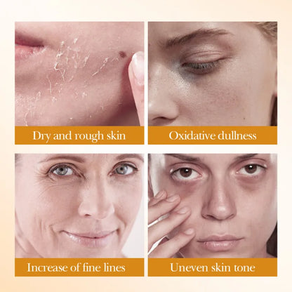 Set de Skincare de Arroz BIOAQUA 5 Piezas – Aclarante, Hidratante y Nutritivo