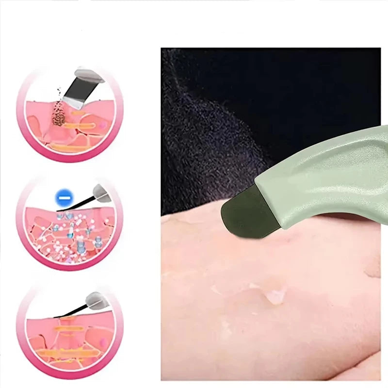 Herramienta de Limpieza Profunda Facial (Extractor de Puntos Negros y Espinillas para la Nariz y el Cuidado de la Piel)