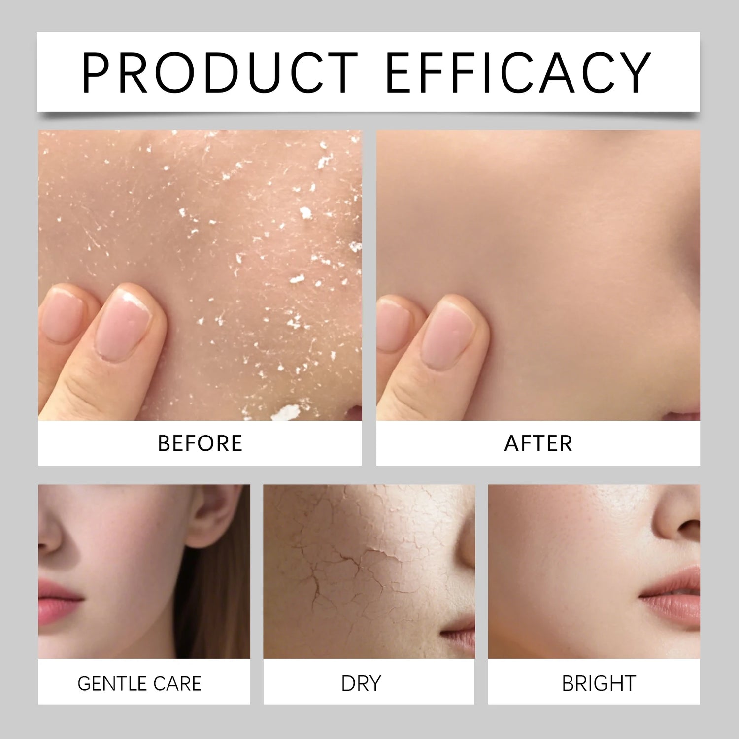 Bruma Hidratante Facial 80ml – Hidratación Profunda para Piel Seca y Sensible