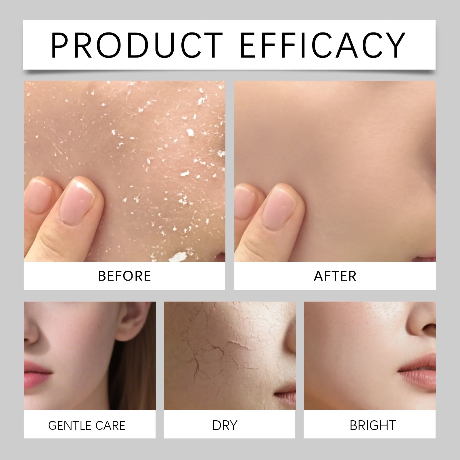 Bruma Hidratante Facial 80ml – Hidratación Profunda para Piel Seca y Sensible