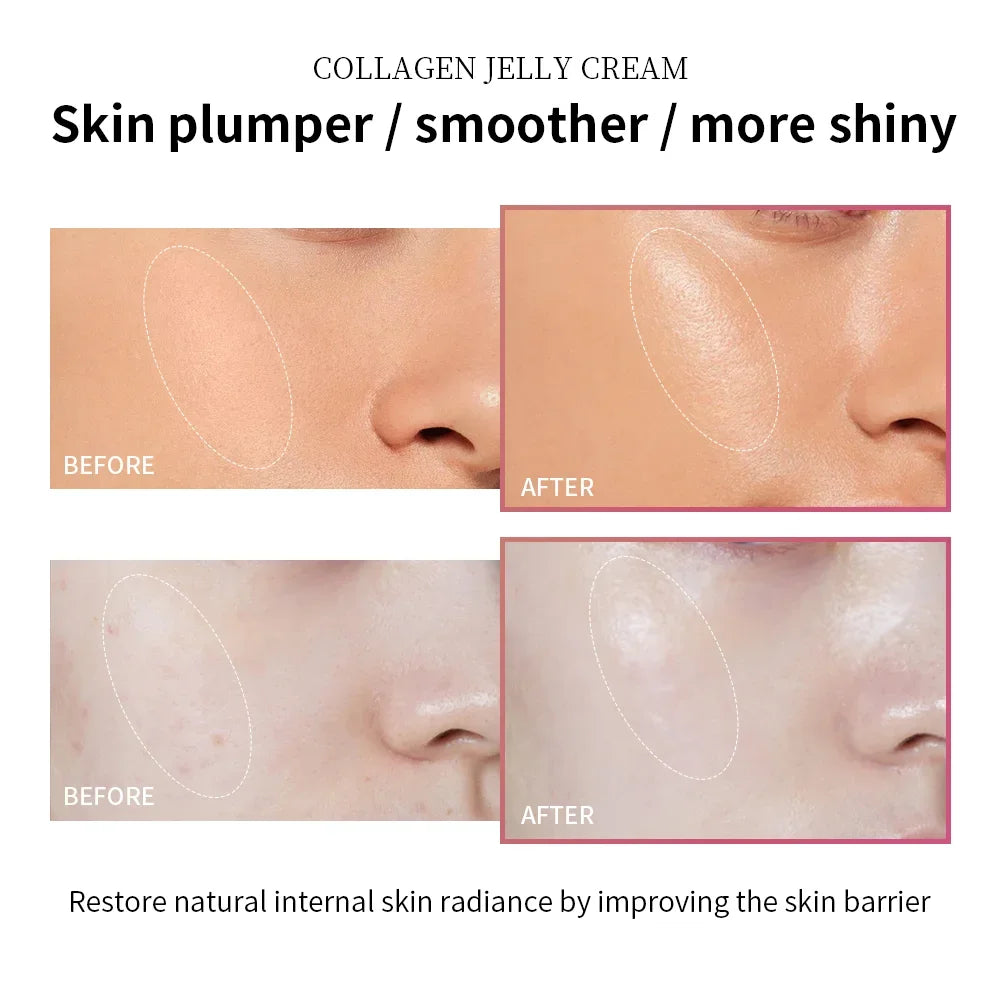 Gel Crema Facial de Colágeno con Niacinamida 100ml – Reafirmante, Calmante e Hidratante